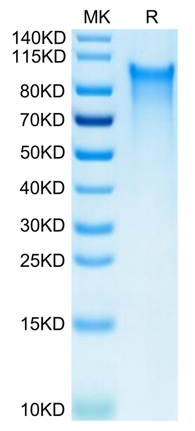 Human CX3CL1 on Tris-Bis PAGE under reduced condition. The purity is greater than 95%.