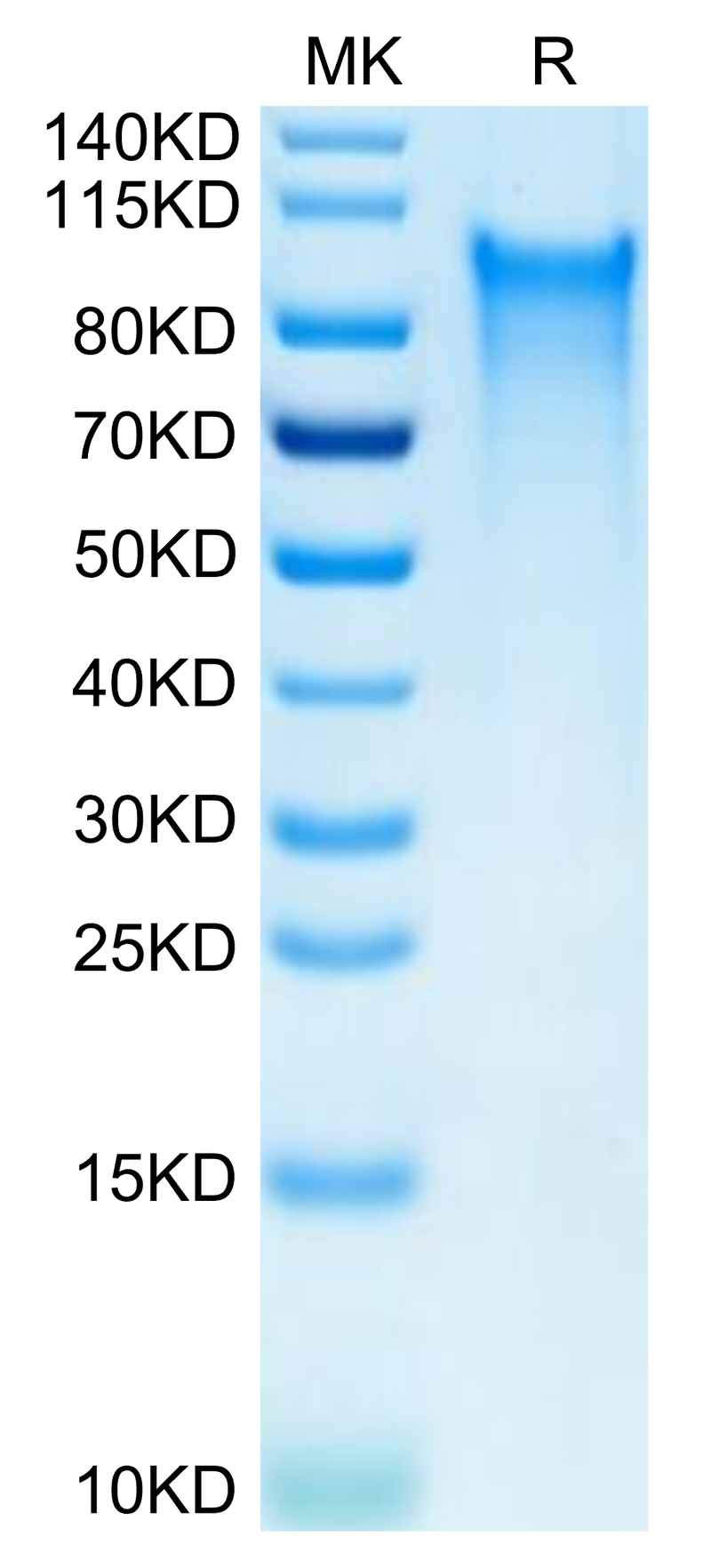 Human CX3CL1 on Tris-Bis PAGE under reduced condition. The purity is greater than 95%.