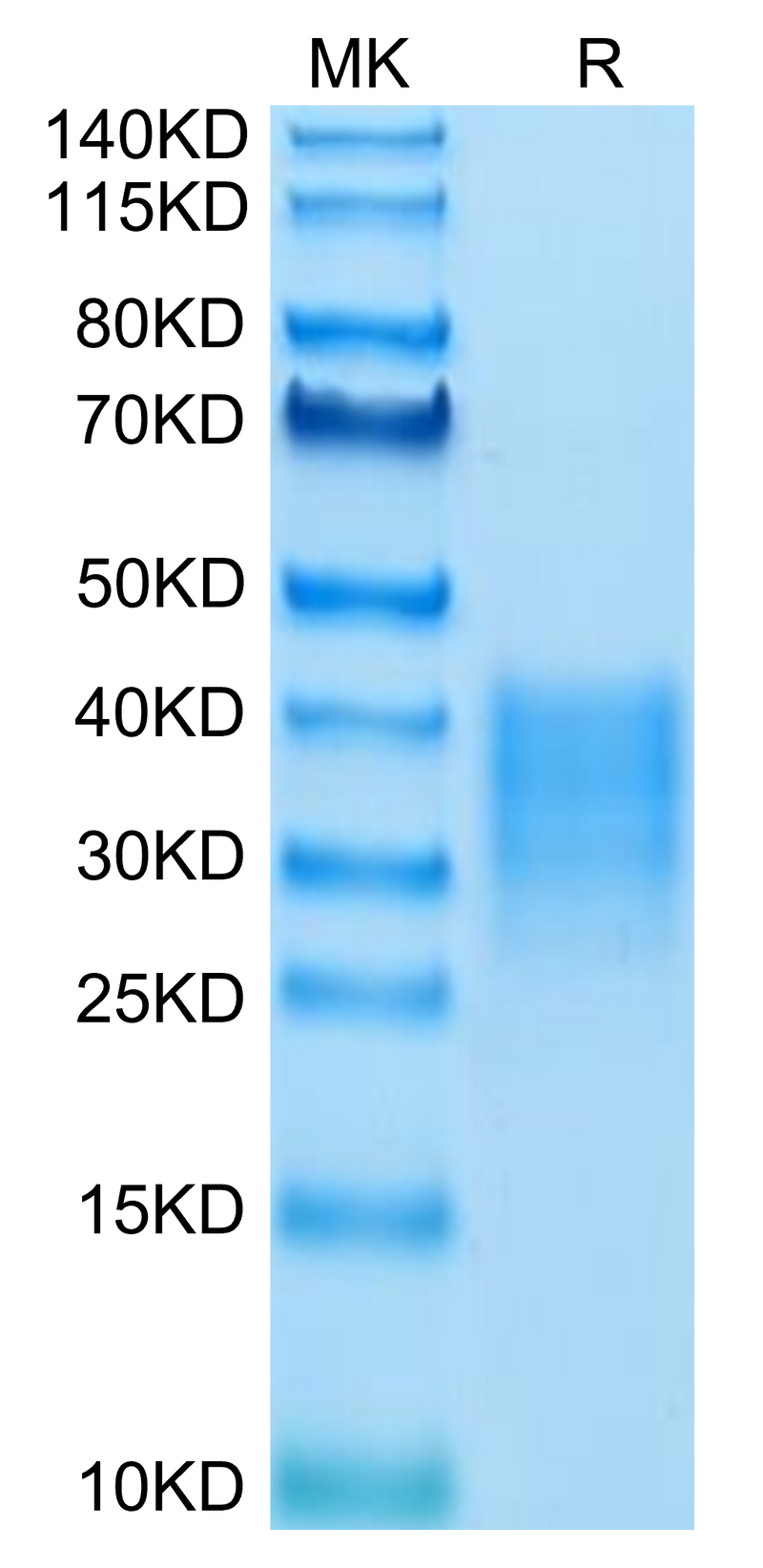 Human Fas on Tris-Bis PAGE under reduced condition. The purity is greater than 95%.