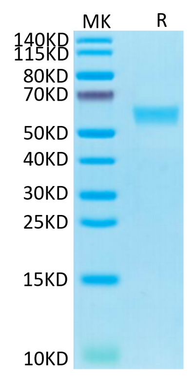 Human Fas on Tris-Bis PAGE under reduced condition. The purity is greater than 95%.