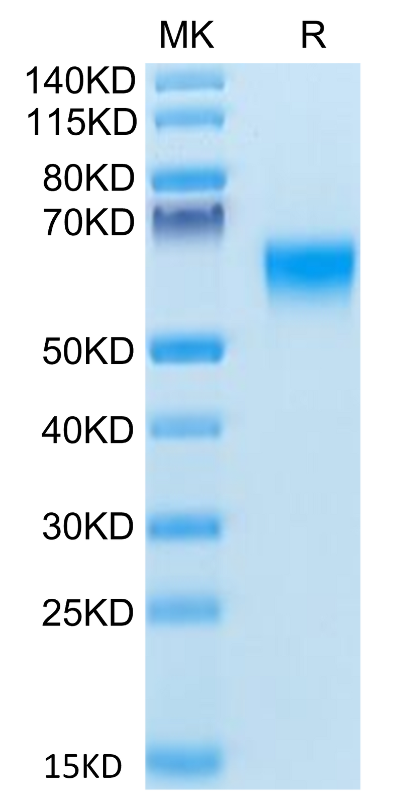 Human BACE-1 on Tris-Bis PAGE under reduced condition. The purity is greater than 95%.