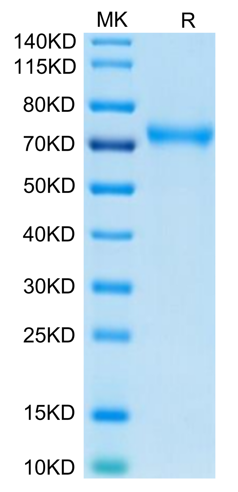 Human CD229 on Tris-Bis PAGE under reduced condition. The purity is greater than 95%.