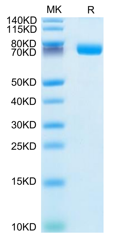 Human IL-1R2 on Tris-Bis PAGE under reduced condition. The purity is greater than 95%.