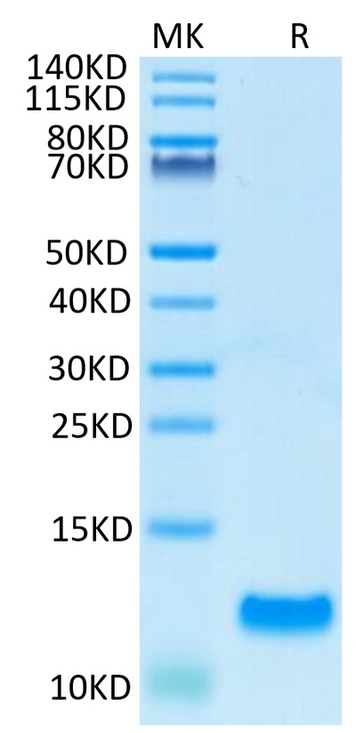 Human CCL20 on Tris-Bis PAGE under reduced condition. The purity is greater than 95%.