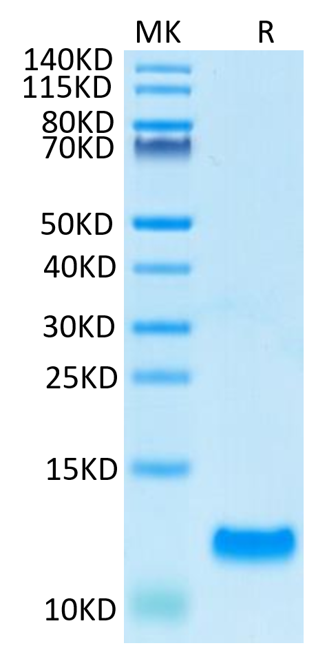 Human CCL20 on Tris-Bis PAGE under reduced condition. The purity is greater than 95%.