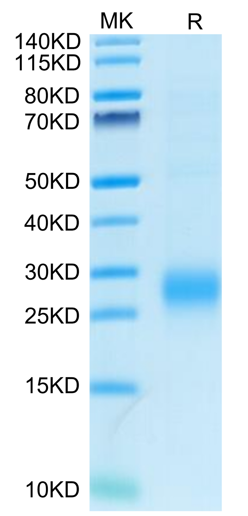 Human ALK-1/ACVRL1 on Tris-Bis PAGE under reduced condition. The purity is greater than 95%.