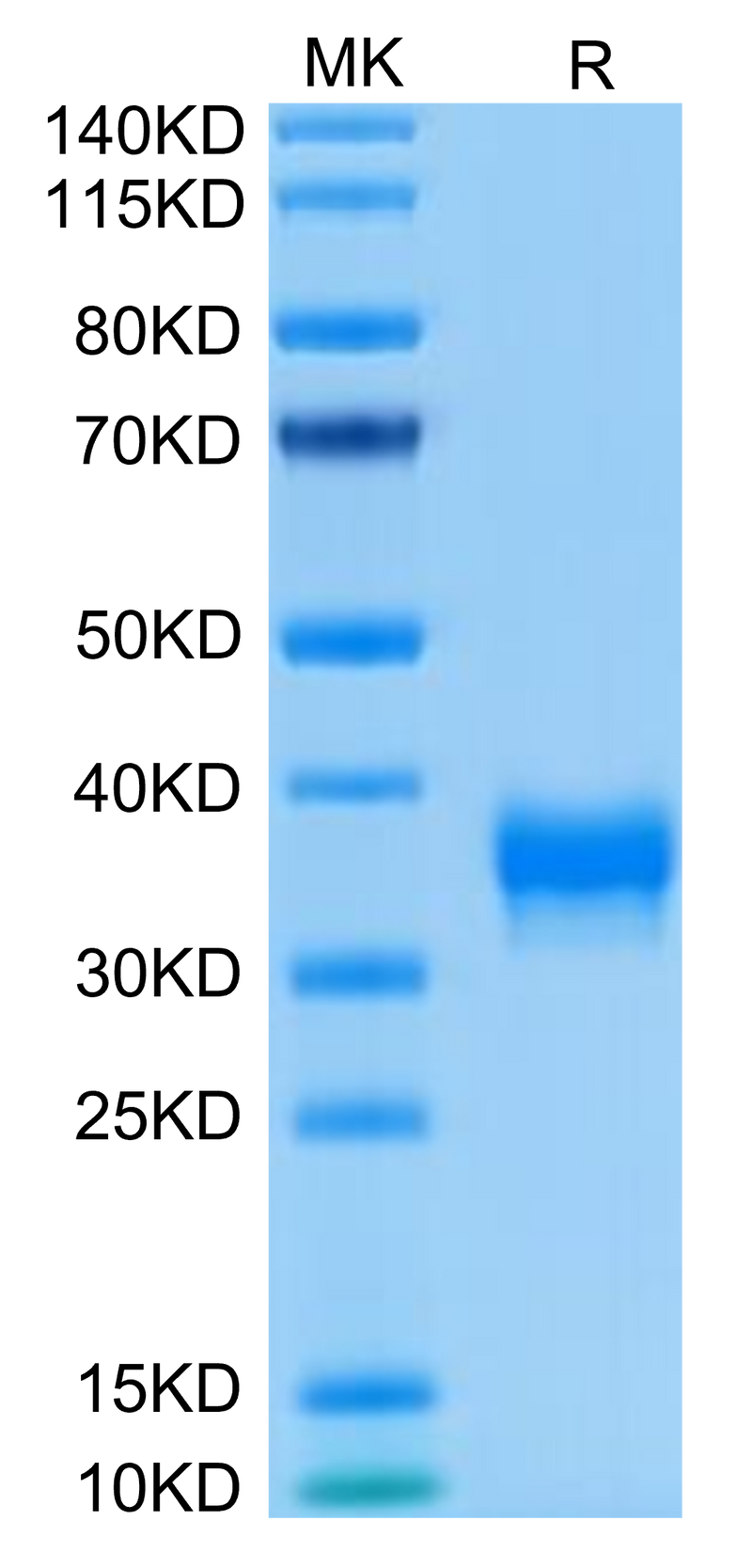 Human BTN1A1 on Tris-Bis PAGE under reduced condition. The purity is greater than 95%.