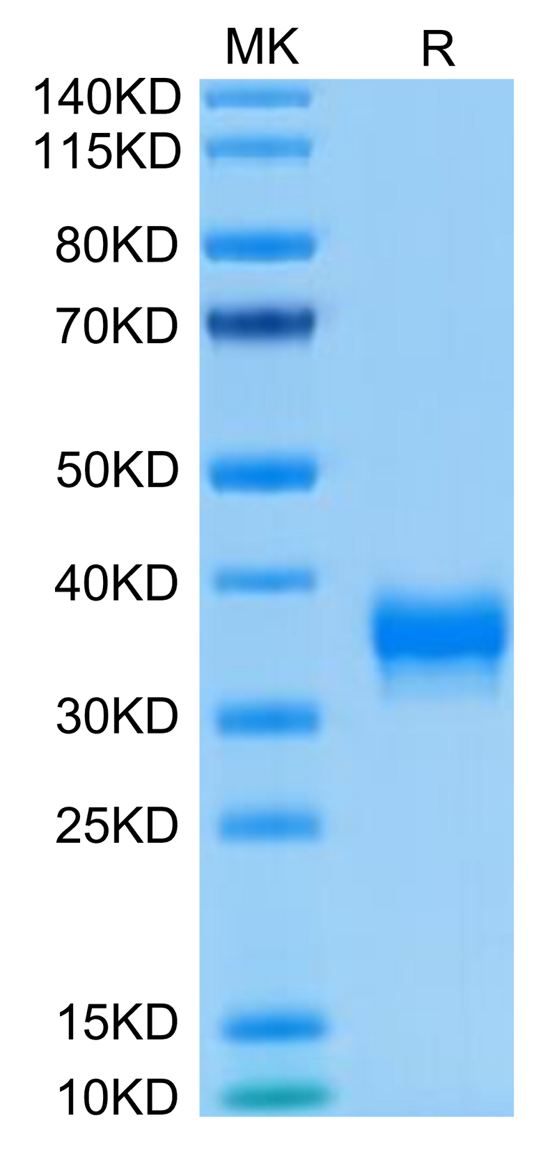 Biotinylated Human BTN1A1 on Tris-Bis PAGE under reduced condition. The purity is greater than 95%.