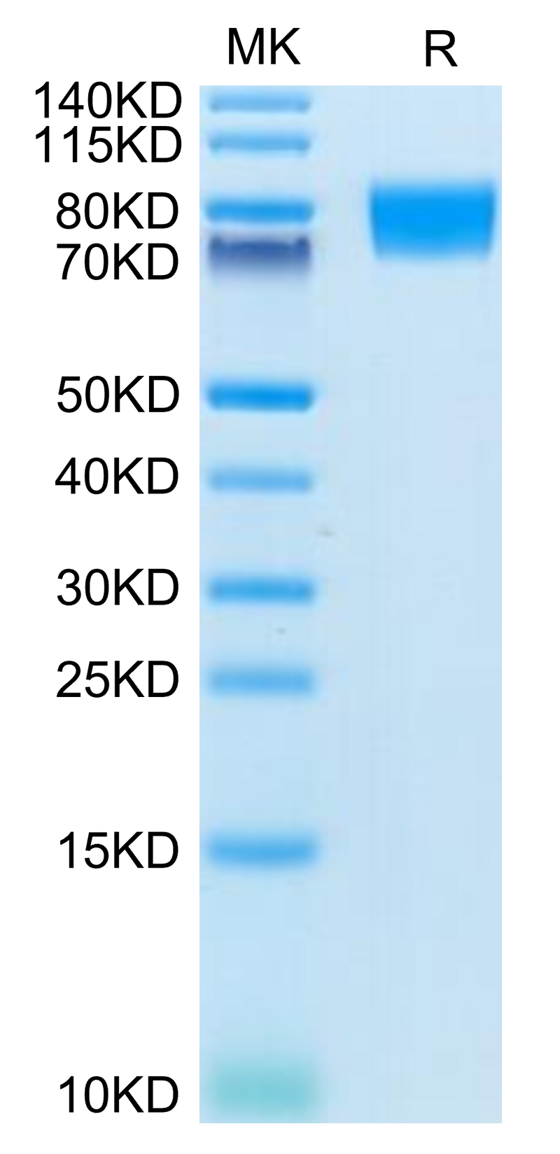 Human CD117 on Tris-Bis PAGE under reduced condition. The purity is greater than 95%.