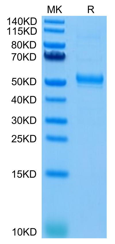 Human CD37 on Tris-Bis PAGE under reduced condition. The purity is greater than 95%.