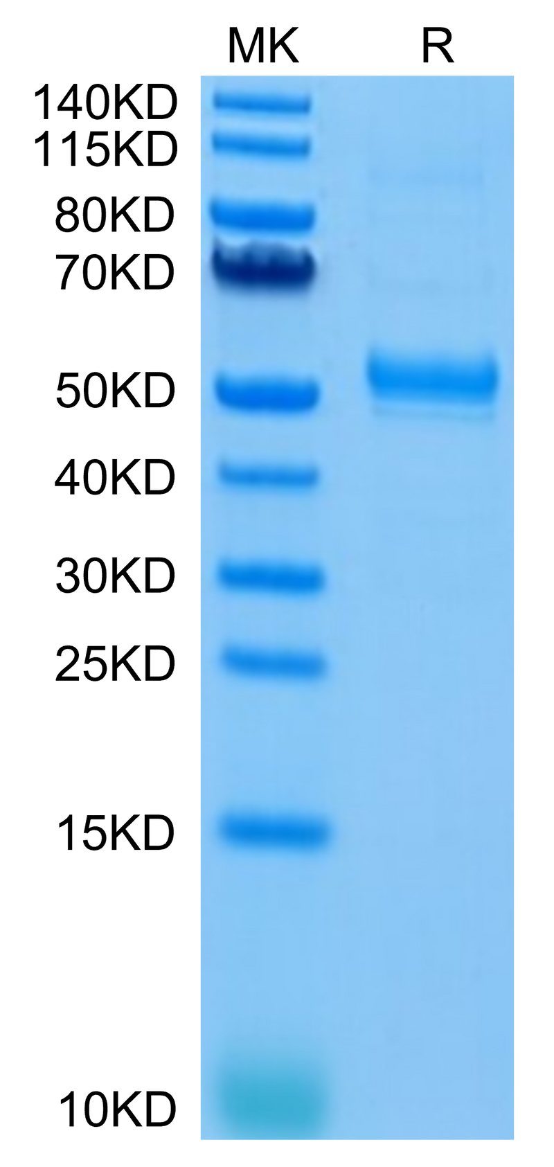 Human CD37 on Tris-Bis PAGE under reduced condition. The purity is greater than 95%.