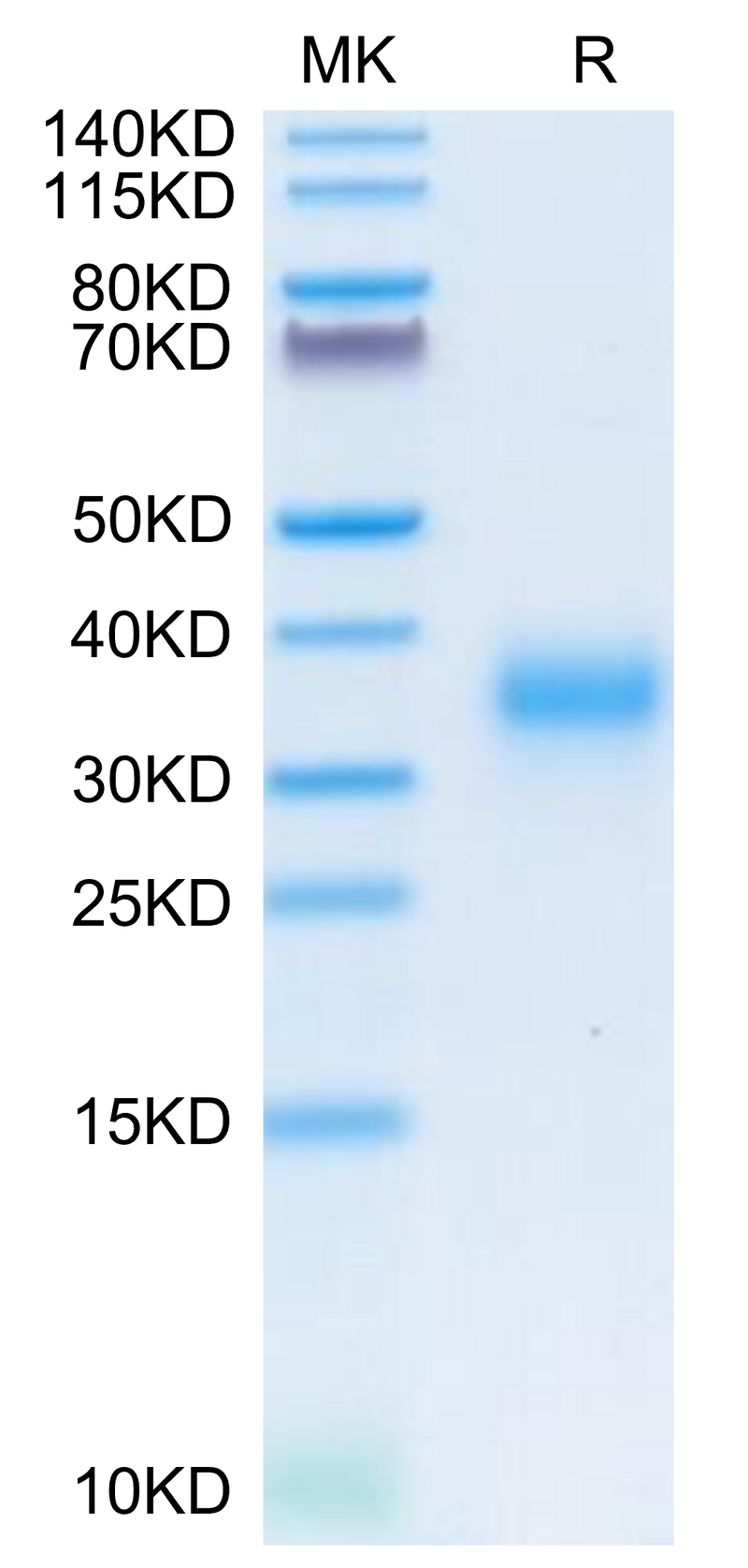 Human CD74 on Tris-Bis PAGE under reduced condition. The purity is greater than 95%.