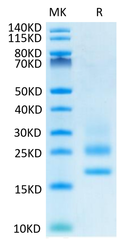 Human CD83 on Tris-Bis PAGE under reduced condition. The purity is greater than 95%.