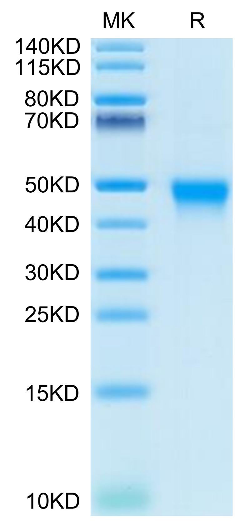 Human CD84 on Tris-Bis PAGE under reduced condition. The purity is greater than 95%.