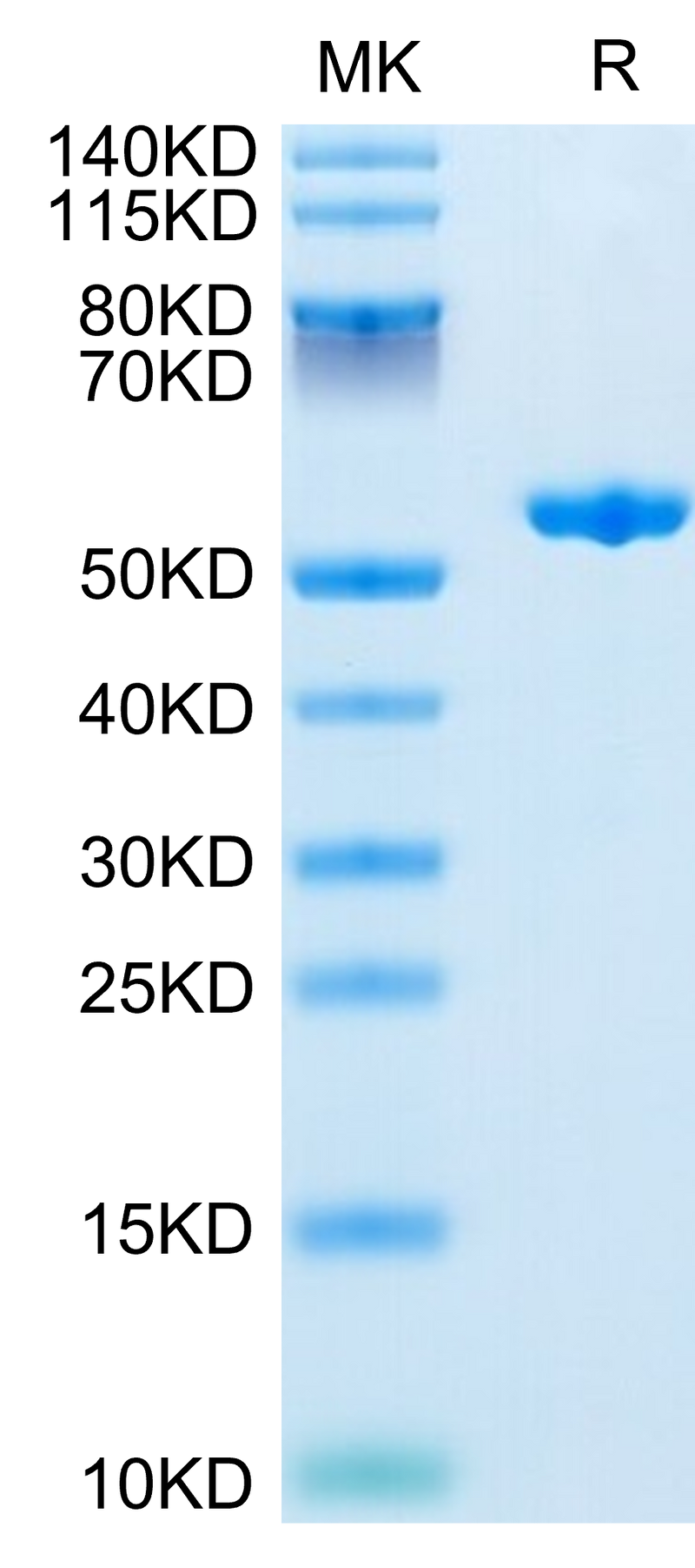 Human Complement Factor D on Tris-Bis PAGE under reduced condition. The purity is greater than 95%.