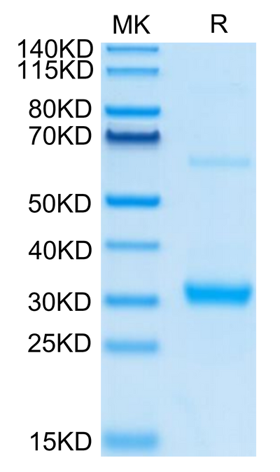 Human CLEC10A on Tris-Bis PAGE under reduced condition. The purity is greater than 95%.