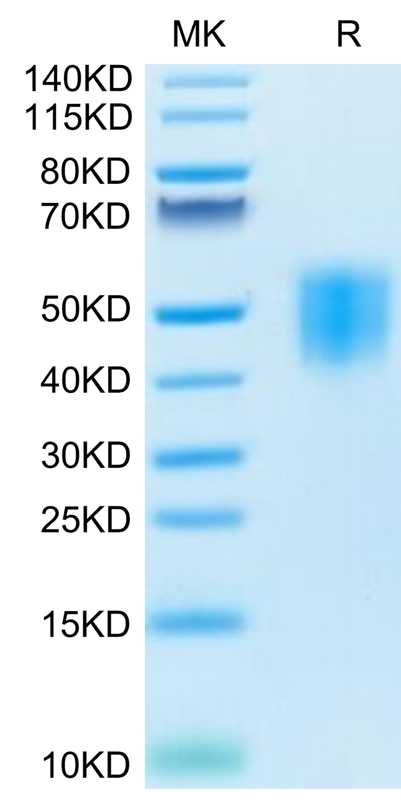 Human GHR on Tris-Bis PAGE under reduced condition. The purity is greater than 95%.