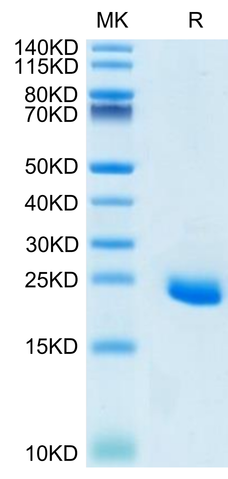 Human Ephrin-A4 on Tris-Bis PAGE under reduced condition. The purity is greater than 95%.