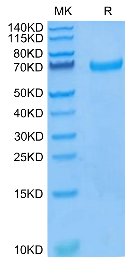 Human EphB4 on Tris-Bis PAGE under reduced condition. The purity is greater than 95%.