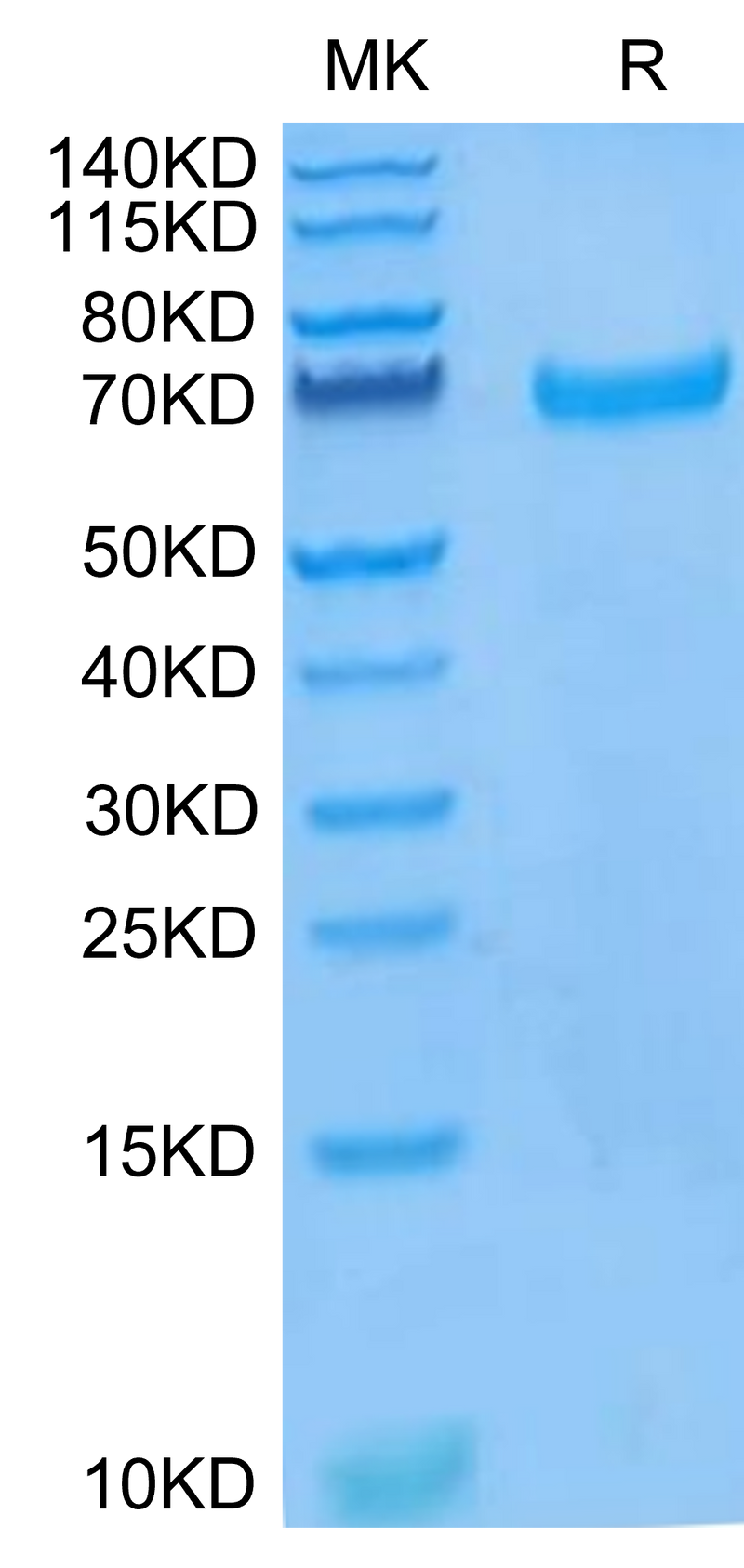 Human EphB4 on Tris-Bis PAGE under reduced condition. The purity is greater than 95%.