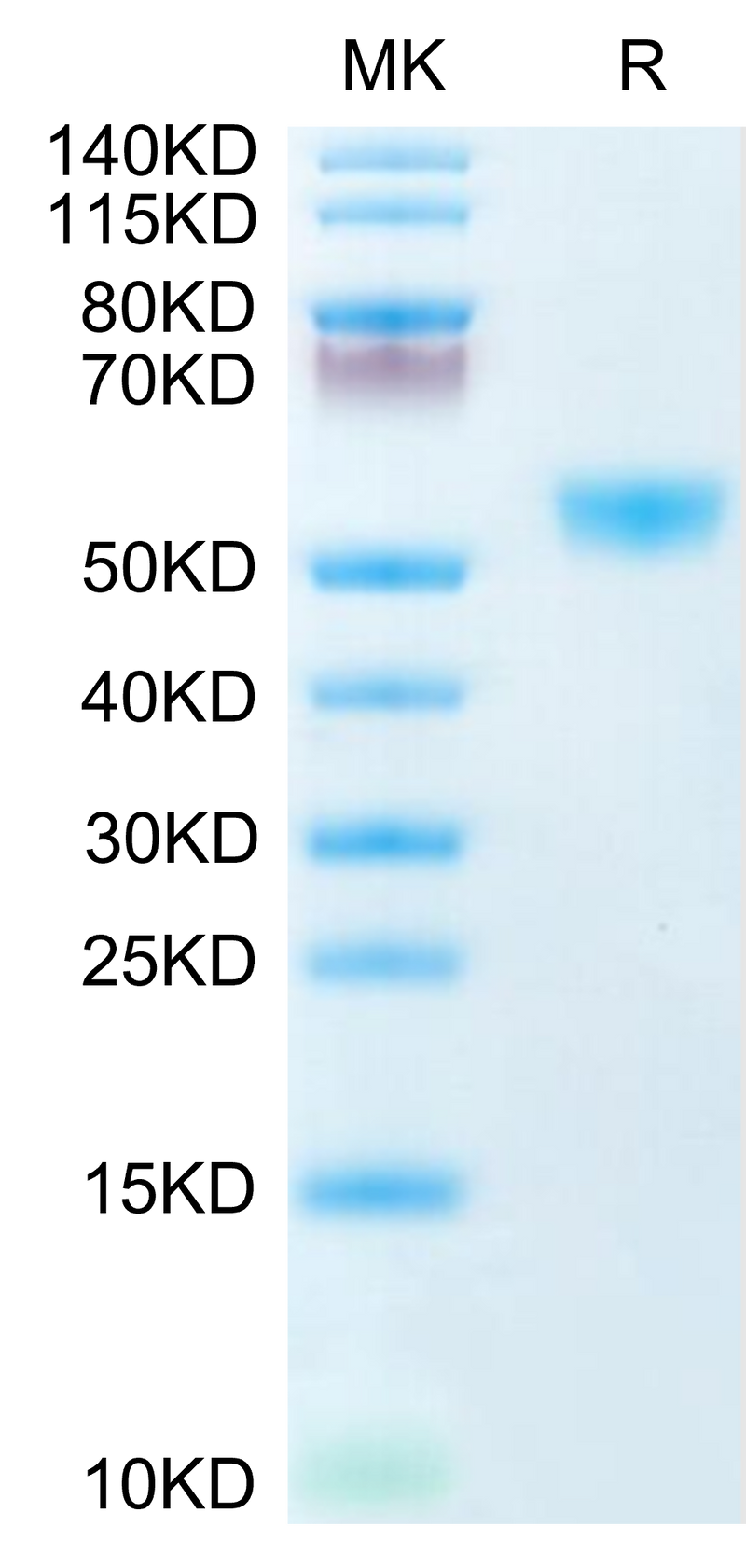 Human CD28H on Tris-Bis PAGE under reduced condition. The purity is greater than 95%.