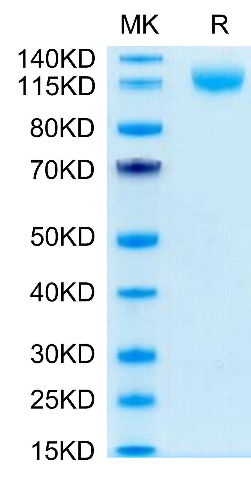 Human VEGF R3 on Tris-Bis PAGE under reduced condition. The purity is greater than 95%.