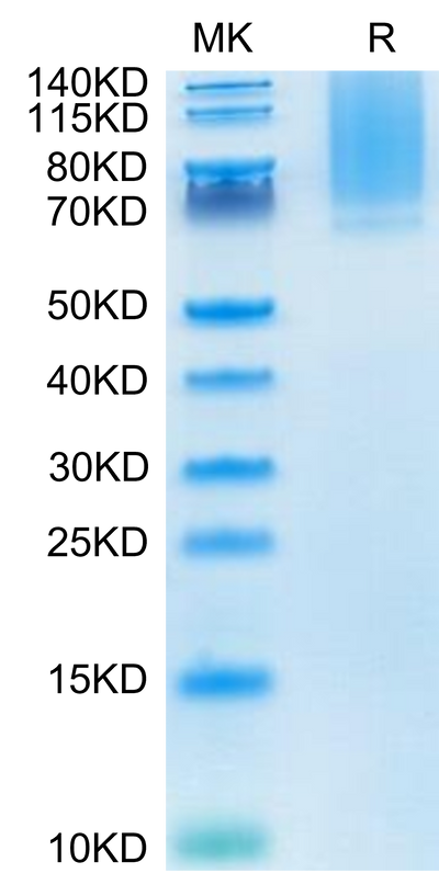 Human Glypican 1 on Tris-Bis PAGE under reduced condition. The purity is greater than 95%.