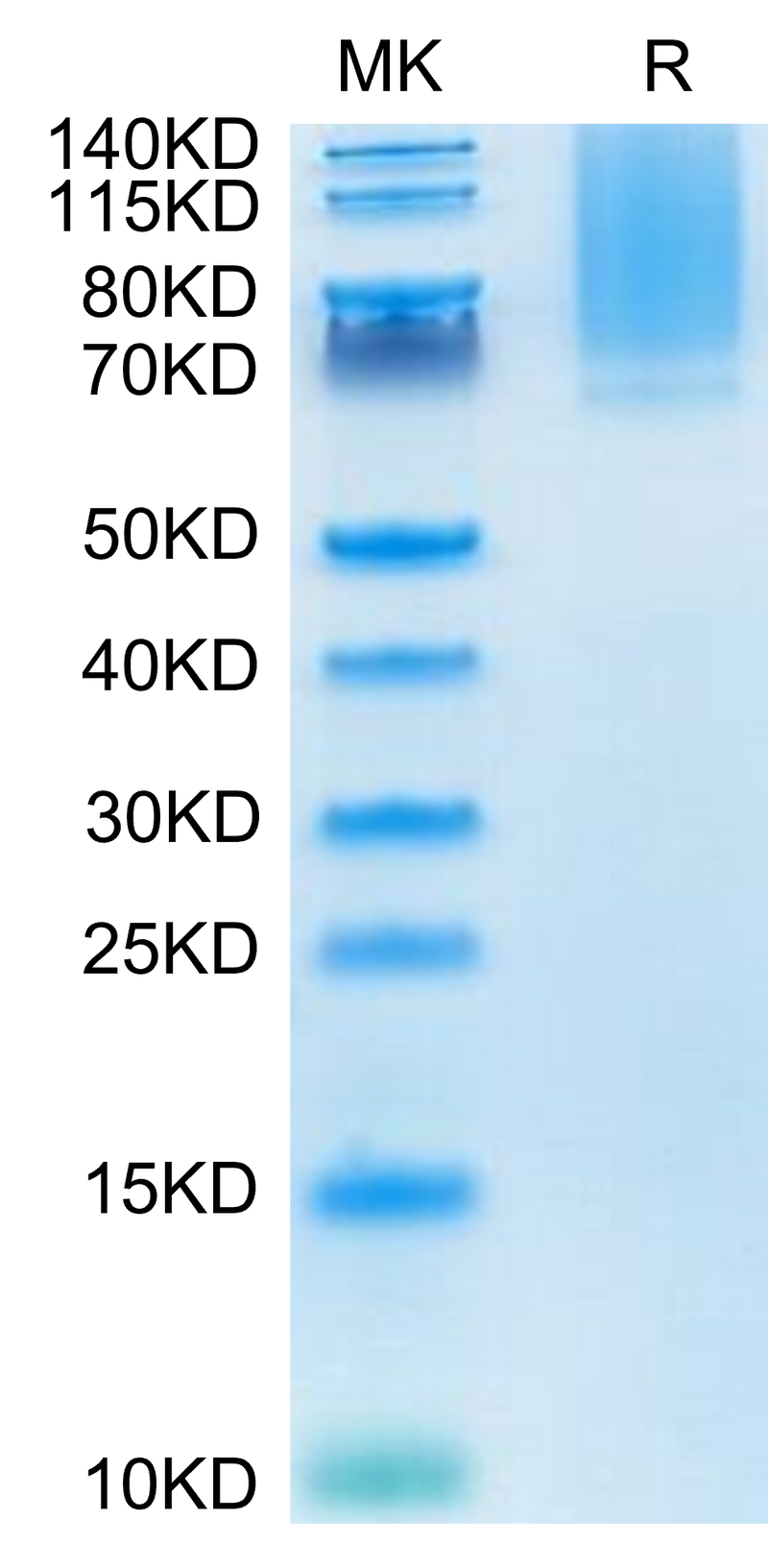 Human Glypican 1 on Tris-Bis PAGE under reduced condition. The purity is greater than 95%.