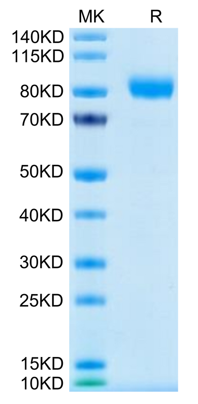 Human GM-CSF R alpha on Tris-Bis PAGE under reduced condition. The purity is greater than 95%.