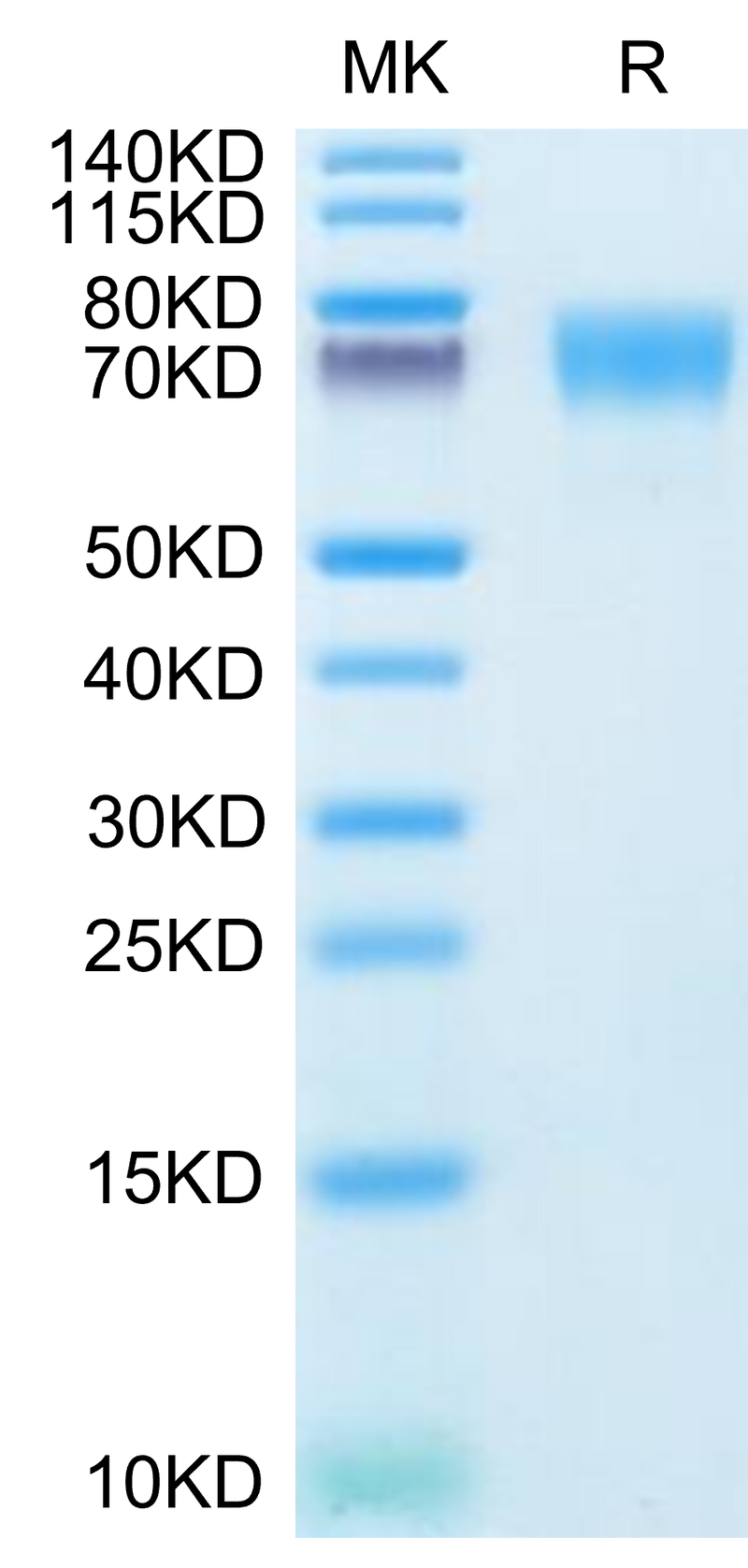 Human ICAM-1 on Tris-Bis PAGE under reduced condition. The purity is greater than 95%.