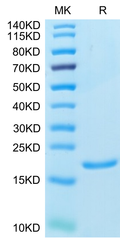 Human IL-1 alpha on Tris-Bis PAGE under reduced condition. The purity is greater than 95%.