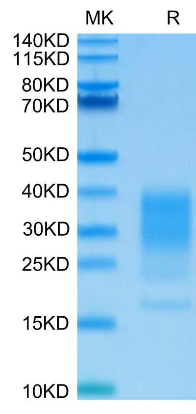 Human IL-22 on Tris-Bis PAGE under reduced condition. The purity is greater than 95%.