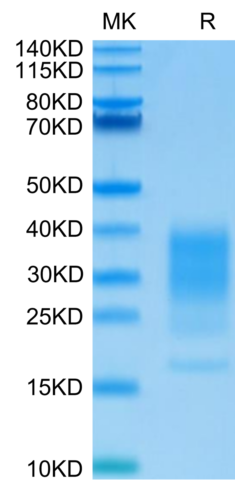 Human IL-22 on Tris-Bis PAGE under reduced condition. The purity is greater than 95%.