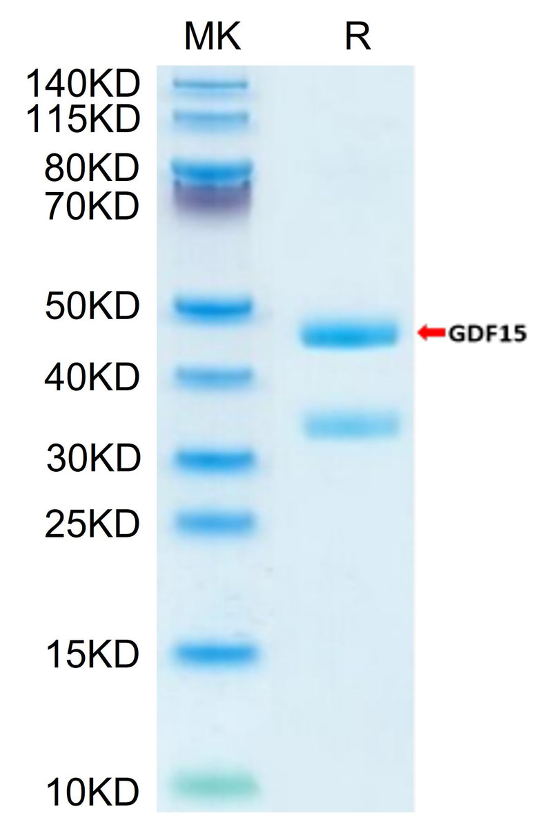 Biotinylated Mouse GDF15 on Tris-Bis PAGE under reduced condition. The purity is greater than 95%.