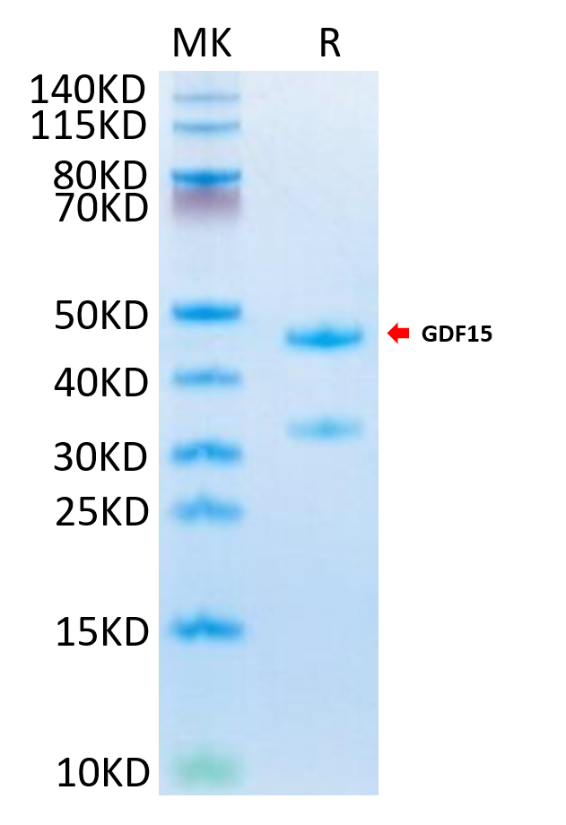 Mouse GDF15 on Tris-Bis PAGE under reduced condition. The purity is greater than 95%.