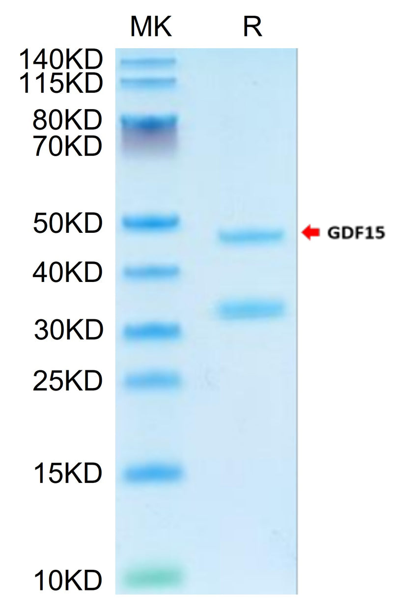 Cynomolgus GDF15 on Tris-Bis PAGE under reduced condition. The purity is greater than 95%.