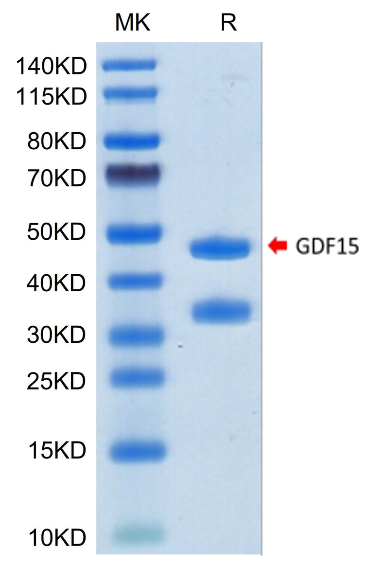 Human GDF15 on Tris-Bis PAGE under reduced condition. The purity is greater than 95%.