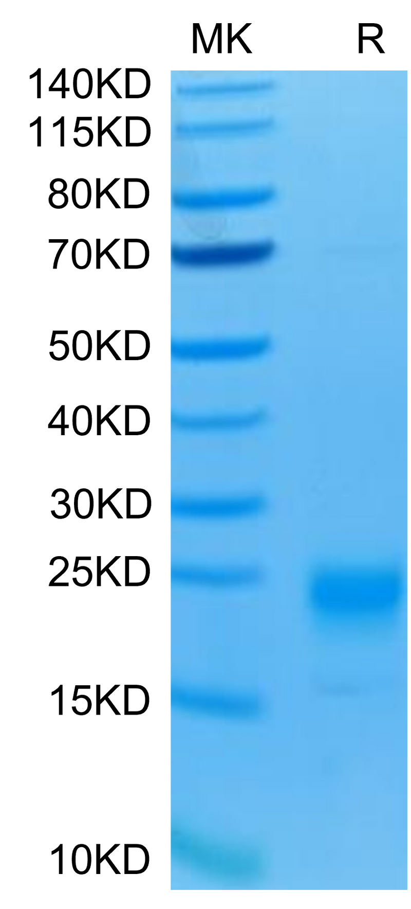 Human IL-5 on Tris-Bis PAGE under reduced condition. The purity is greater than 95%.