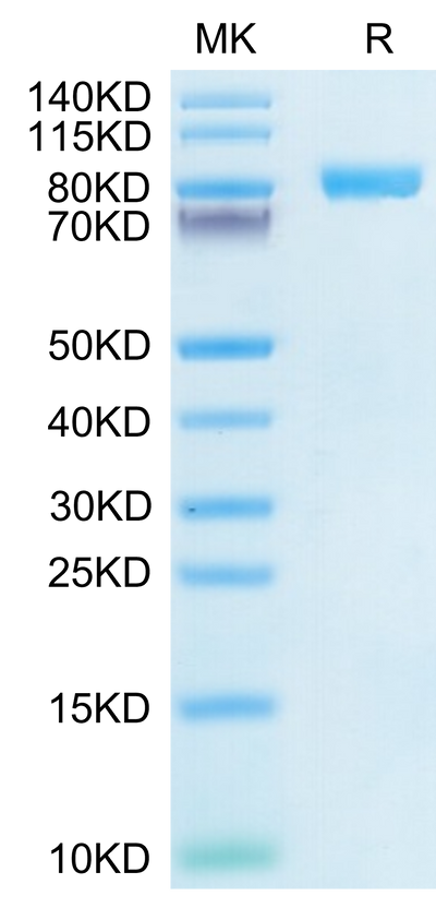 Human IL-6 R alpha on Tris-Bis PAGE under reduced condition. The purity is greater than 95%.