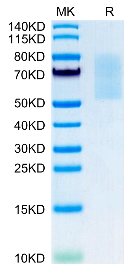 Mouse CX3CL1 on Tris-Bis PAGE under reduced condition. The purity is greater than 95%.