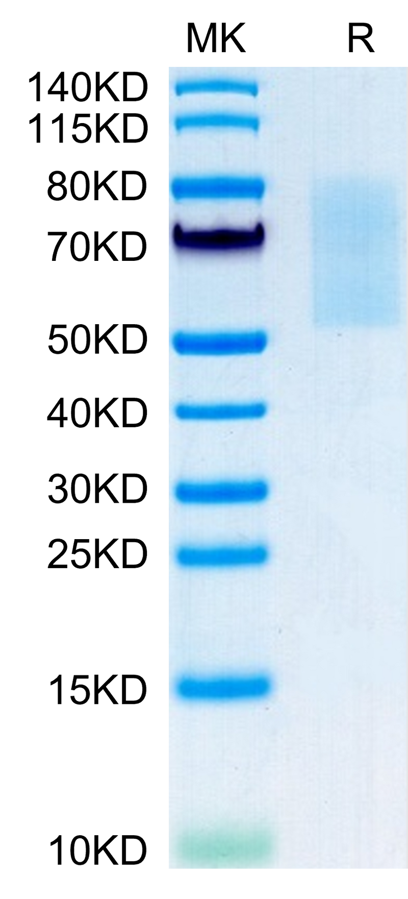 Mouse CX3CL1 on Tris-Bis PAGE under reduced condition. The purity is greater than 95%.