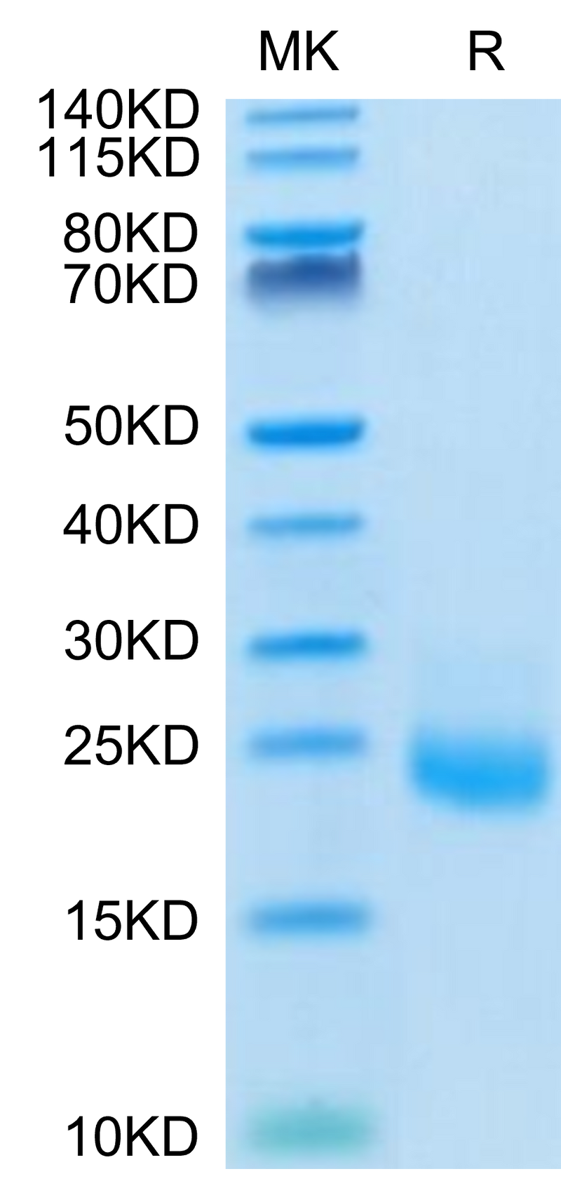 Human IL-31 on Tris-Bis PAGE under reduced condition. The purity is greater than 95%.