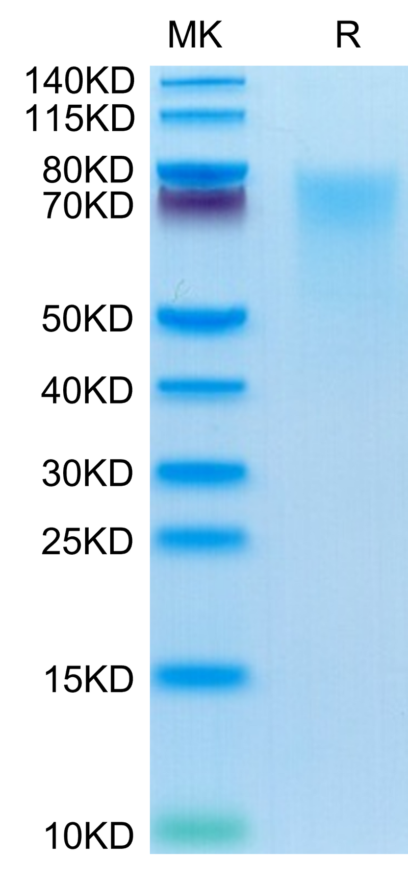 Human BSPII on Tris-Bis PAGE under reduced condition. The purity is greater than 95%.