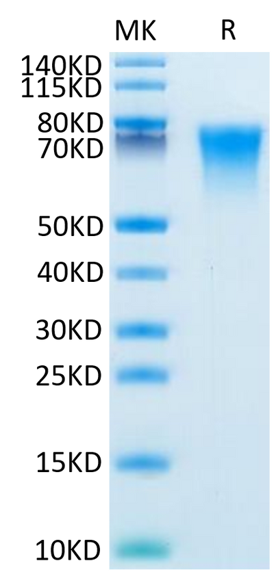 Mouse BSPII on Tris-Bis PAGE under reduced condition. The purity is greater than 95%.