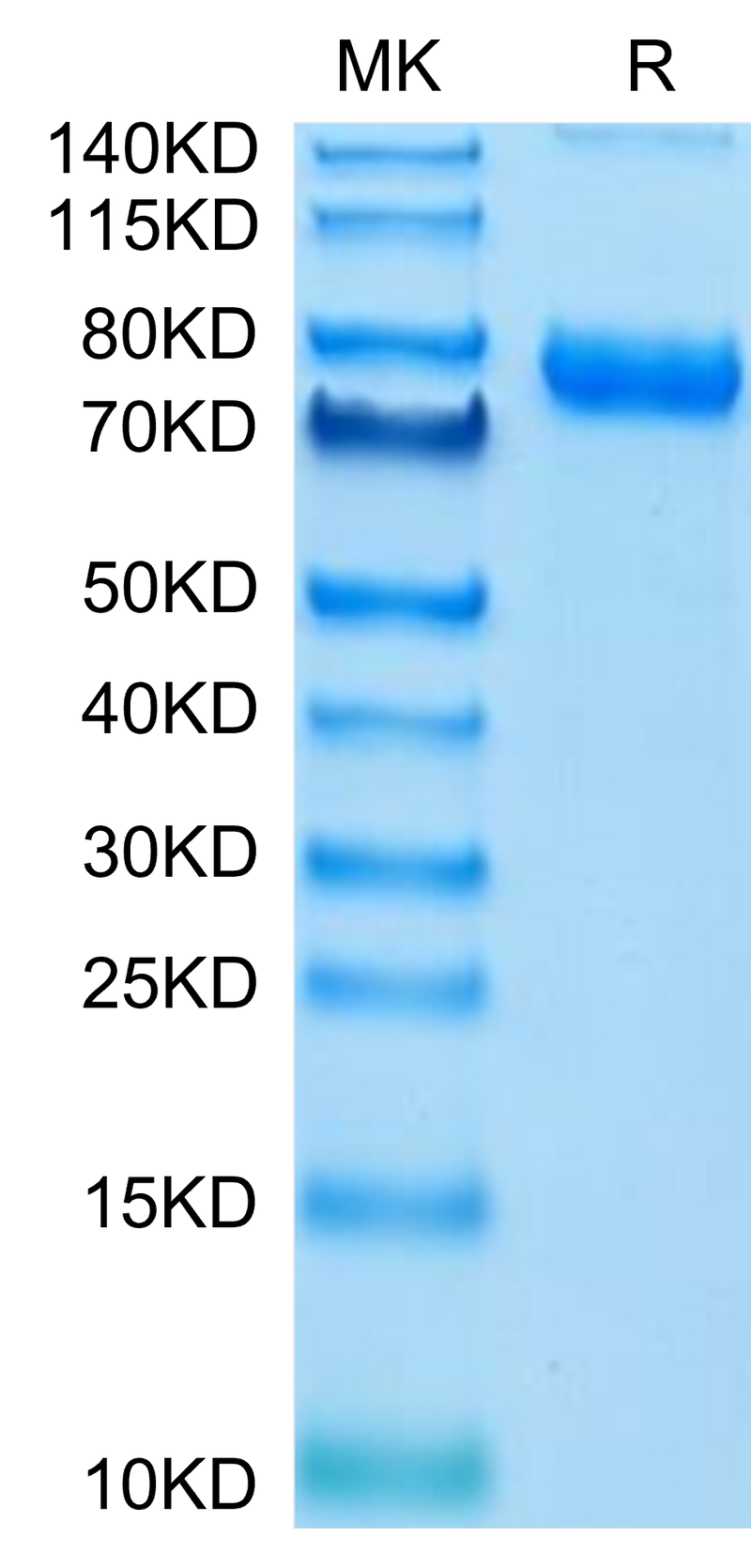 Cynomolgus Transferrin R on Tris-Bis PAGE under reduced condition. The purity is greater than 95%.