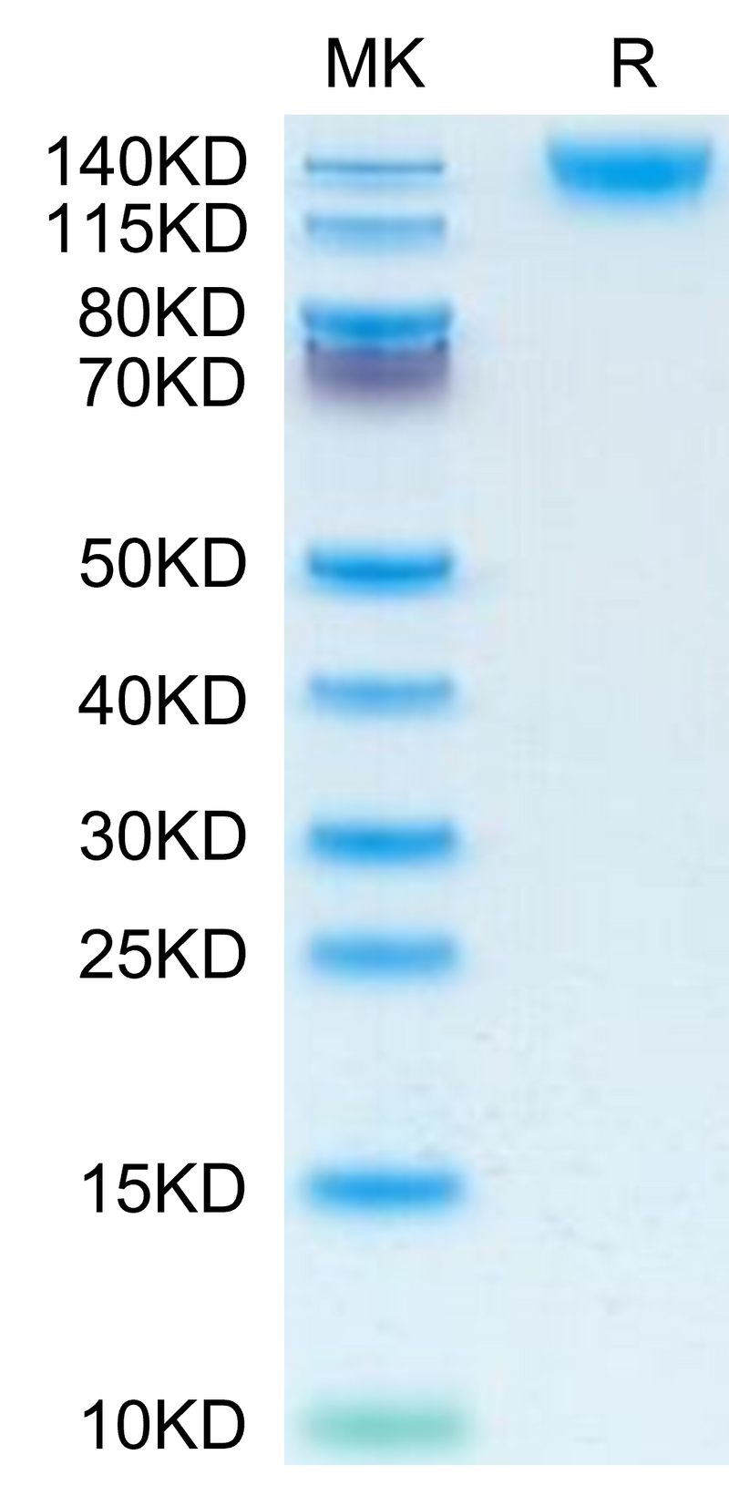 Human CD45 on Tris-Bis PAGE under reduced condition. The purity is greater than 95%.