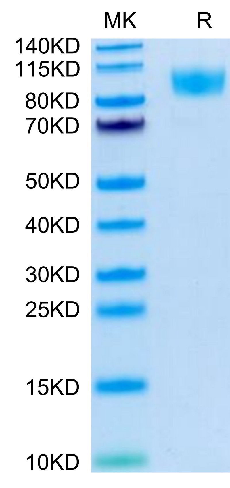 Biotinylated Human CD45 on Tris-Bis PAGE under reduced condition. The purity is greater than 95%.