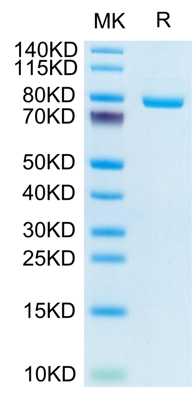 Human Transferrin R on Tris-Bis PAGE under reduced condition. The purity is greater than 95%.