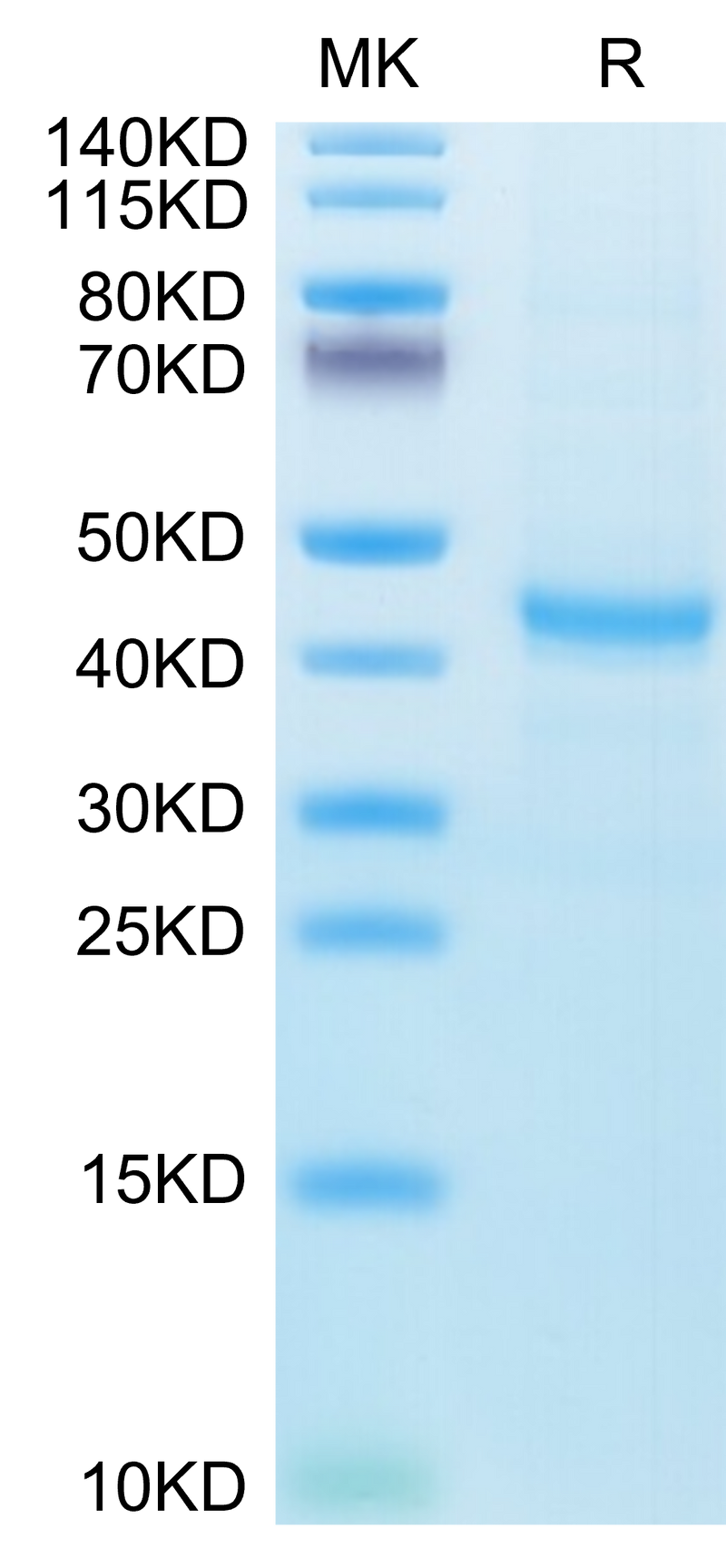 Human CXCL13 on Tris-Bis PAGE under reduced condition. The purity is greater than 95%.