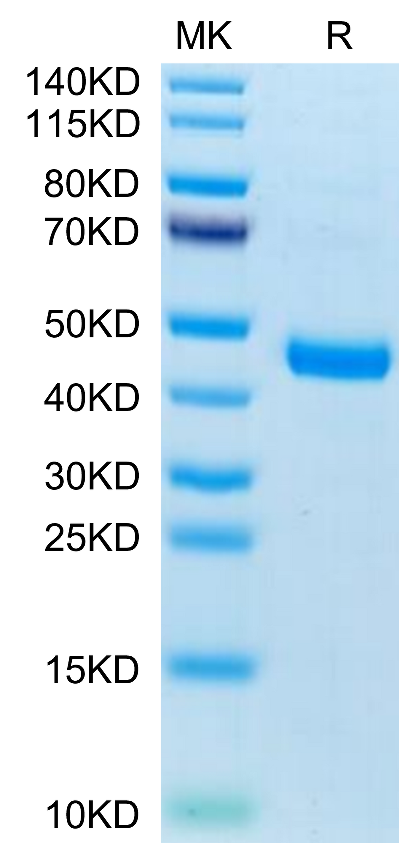 Mouse CXCL13 on Tris-Bis PAGE under reduced condition. The purity is greater than 95%.